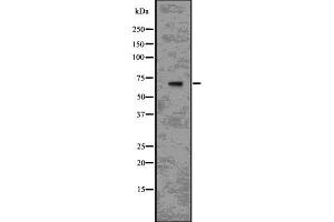 Western blot analysis of IL1R1 using RAW264.