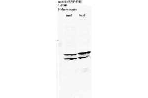Western blot of anti-hnRNP-F/H on HeLa cell extract (HNRNPL anticorps)