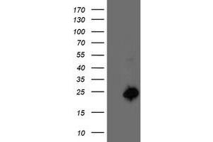 Western Blotting (WB) image for anti-Centromere Protein H (CENPH) antibody (ABIN1497471) (CENPH anticorps)