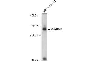 Western blot analysis of extracts of mouse heart, using M antibody (ABIN7268457) at 1:1000 dilution. (MAGEH1 anticorps  (AA 10-90))