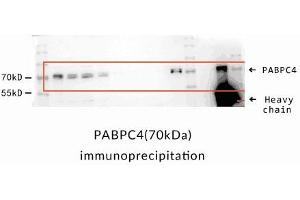 Immunoprecipitation(IP) analysis of SK-Hep1 cells, using PABPC4 antibody .