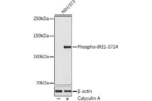 Western blot analysis of extracts of NIH/3T3 cells, using Phospho-IRE1-S724 antibody  at 1:500 dilution. (ERN1 anticorps  (pSer724))