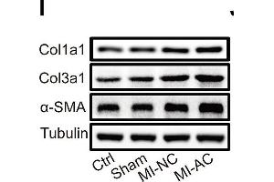 Activated CD4+ T cells-derived exosomes deteriorate cardiac function post-MI in mouse.