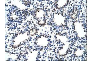 Image no. 1 for anti-Cysteinyl-tRNA Synthetase (CARS) (AA 31-80) antibody (ABIN6736227)