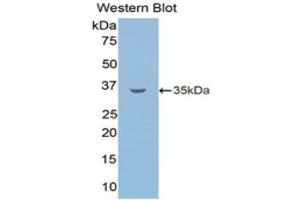 Western Blotting (WB) image for anti-Lipolysis Stimulated Lipoprotein Receptor (LSR) (AA 335-589) antibody (ABIN1859717) (LSR anticorps  (AA 335-589))