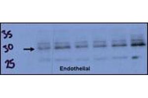 Endothelial cell lysate transferred to membrane was incubated with primary antibody at a 1:500 dilution in 2% BSA in TBST at 4 deg C overnight.