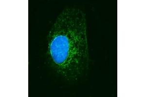 anti-Mitochondrial Ribosomal Protein S22 (MRPS22) (AA 21-329) antibody