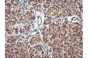 Image no. 1 for anti-Parvin, alpha (PARVA) antibody (ABIN1496443)