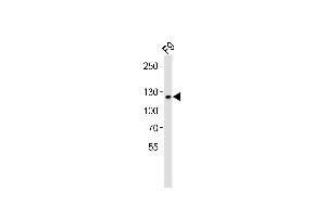 Western blot analysis of lysate from mouse F9 cell line, using Mouse Sirt1 Antibody (C-term) (ABIN6242824 and ABIN6577619).