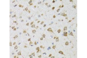 Immunohistochemistry of paraffin-embedded Rat brain using PI3 Polyclonal Antibody at dilution of 1:100 (40x lens). (PI3 anticorps)