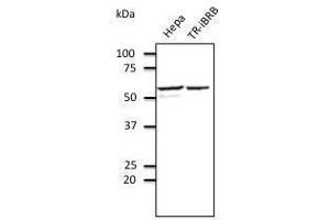Anti-EEAI Ab at 1/500 dilution, Rabbit polyclonal to goat lµg (HRP) at 1/10,000 dilution, (PDIA3 anticorps  (C-Term))
