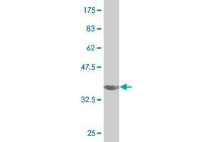 Western Blot detection against Immunogen (34.