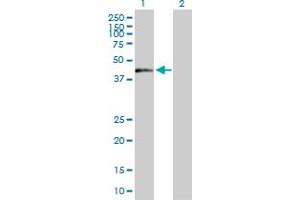 Western Blot analysis of ZNF584 expression in transfected 293T cell line by ZNF584 MaxPab polyclonal antibody. (ZNF584 anticorps  (AA 1-421))