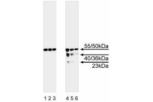 Western blot analysis of caspase-8. (Caspase 8 anticorps  (full length))