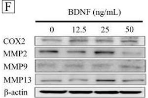The effects of brain-derived neurotrophic factor (BDNF) on autoregulation, migration and migration related proteins signaling in MDA-MB-231 cells.