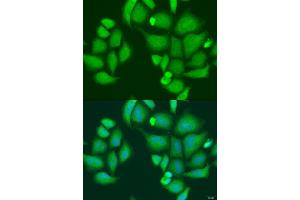 Immunofluorescence analysis of U2OS cells using CAPN2 antibody (ABIN2736399) at dilution of 1:100. (Calpain 2 anticorps)
