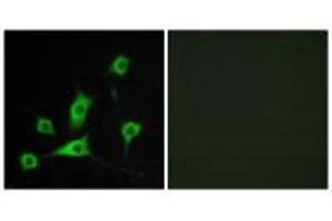 Immunofluorescence analysis of LOVO cells, using CRBP III antibody. (Retinol Binding Protein 5 anticorps)