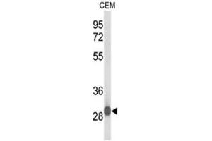 Western blot analysis of C15orf29 Antibody (N-term) in CEM cell line lysates (35µg/lane). (KATNBL1 anticorps  (N-Term))