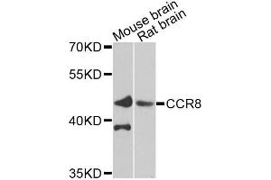 Western blot analysis of extracts of various cells, using CCR8 antibody. (CCR8 anticorps)