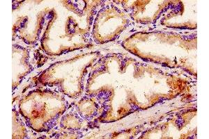 IHC image of ABIN7154307 diluted at 1:500 and staining in paraffin-embedded human prostate tissue performed on a Leica BondTM system.