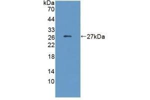 Detection of Recombinant CRP, Human using Monoclonal Antibody to C Reactive Protein (CRP) (CRP anticorps  (AA 17-224))