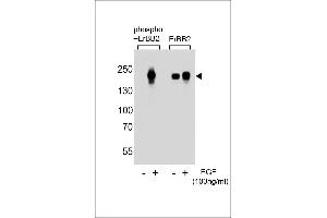 Western blot analysis of extracts from A431 cells, untreated or treated with EGF at 100 ng/mL, using phospho-ErBB2  (left) or ErBB2 antibody (right). (ErbB2/Her2 anticorps  (pTyr1112))