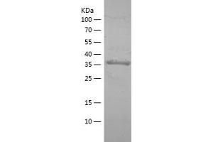 Western Blotting (WB) image for Arylsulfatase A (ARSA) (AA 367-485) protein (His-IF2DI Tag) (ABIN7121904) (Arylsulfatase A Protein (ARSA) (AA 367-485) (His-IF2DI Tag))