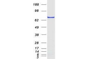 Validation with Western Blot