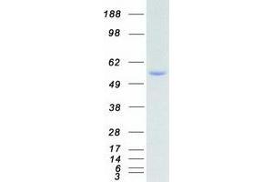 Validation with Western Blot