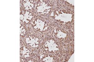 Immunohistochemical analysis of (ABIN391830 and ABIN2841673) on paraffin-embedded Human colon tissue. (HSP70 1A anticorps  (AA 19-48))