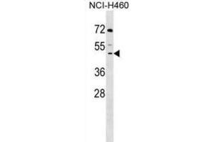 Western Blotting (WB) image for anti-Decapping Enzyme, Scavenger (DCPS) antibody (ABIN2999210) (DCPS anticorps)