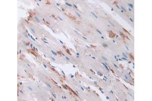 Used in DAB staining on fromalin fixed paraffin- embedded heart tissue (RHAG anticorps  (AA 251-450))