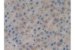 Detection of CFLAR in Rat Liver Tissue using Polyclonal Antibody to CASP8 And FADD Like Apoptosis Regulator (CFLAR)