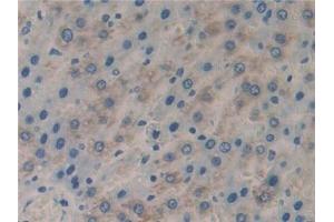 Detection of CFLAR in Rat Liver Tissue using Polyclonal Antibody to CASP8 And FADD Like Apoptosis Regulator (CFLAR) (FLIP anticorps  (AA 43-281))