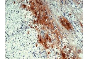 Immunohistochemistry staining of human pituitary gland (frozen sections) with anti-human beta Endorphin (B31.