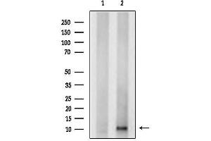 Western blot analysis of lysates from 293T, using AC Antibody.