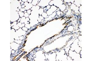 IHC-P: FGFR3 antibody testing of rat lung tissue (FGFR3 anticorps  (N-Term))