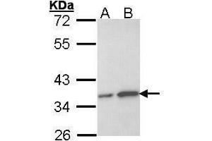 WB Image Sample (30 ug of whole cell lysate) A: Hela B: Hep G2 , 12% SDS PAGE antibody diluted at 1:1000