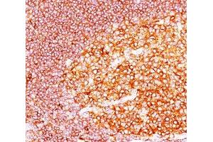 IHC staining of tonsil tissue with MALT1 antibody (MT1/410). (MALT1 anticorps  (AA 701-808))