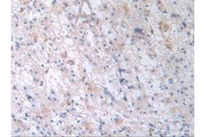 Figure. (TTR anticorps  (AA 21-147))