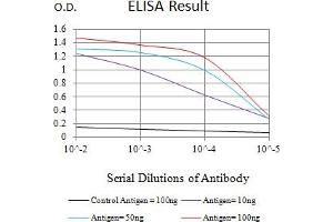 Black line: Control Antigen (100 ng),Purple line: Antigen (10 ng), Blue line: Antigen (50 ng), Red line:Antigen (100 ng) (HLA-B anticorps  (AA 209-295))