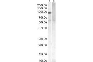 ABIN184701 (0. (PLK4 anticorps  (N-Term))