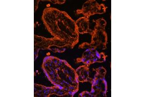 Immunofluorescence analysis of human placenta cells using LDB3 antibody (ABIN6128179, ABIN6143125, ABIN6143126 and ABIN6223347) at dilution of 1:100.