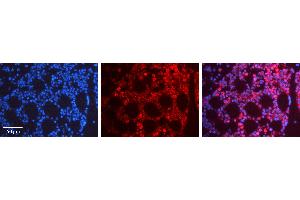 Rabbit Anti-FOS Antibody   Formalin Fixed Paraffin Embedded Tissue: Human Bone Marrow Tissue Observed Staining: Nucleus, Cytoplasm Primary Antibody Concentration: 1:600 Other Working Concentrations: N/A Secondary Antibody: Donkey anti-Rabbit-Cy3 Secondary Antibody Concentration: 1:200 Magnification: 20X Exposure Time: 0.