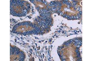 Immunohistochemistry (IHC) image for anti-IL2-Inducible T-Cell Kinase (ITK) antibody (ABIN5548566) (ITK anticorps)
