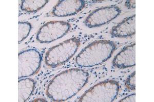 Used in DAB staining on fromalin fixed paraffin- embedded rectum tissue (RNASE10 anticorps  (AA 27-216))