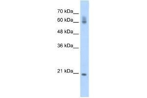 WB Suggested Anti-FIP1L1 Antibody Titration:  0. (FIP1L1 anticorps  (C-Term))