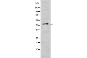 Western blot analysis of KR2_VZVD using HepG2 whole cell lysates (VZV Protein kinase ORF47 anticorps)