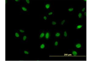 Immunofluorescence of monoclonal antibody to SURB7 on HeLa cell.