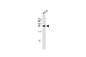 Anti-NDFIP1 Antibody (Center) at 1:1000 dilution + PC-3 whole cell lysate Lysates/proteins at 20 μg per lane.